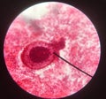 Cells in reproductive female cytology and histology concept