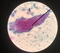 Cells in reproductive female cytology and histology concept