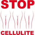 Cellulite