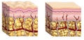 Cellulite cross section Royalty Free Stock Photo