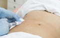 Cellulite mesotherapy Royalty Free Stock Photo