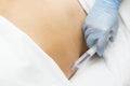 Cellulite mesotherapy Royalty Free Stock Photo