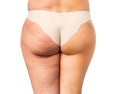 Cellulite problem concept, before and after Royalty Free Stock Photo