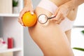 Cellulite problem concept, young woman holding orange near her leg Royalty Free Stock Photo