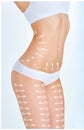 The cellulite removal plan. White markings on young woman body Royalty Free Stock Photo