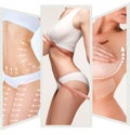 The cellulite removal plan. White markings on young woman body