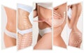 The cellulite removal plan. White markings on young woman body Royalty Free Stock Photo