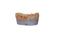 Ceramic crown of a tooth on a plaster model of teeth isolated on a white background, the work of a dental technician Royalty Free Stock Photo