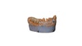 Ceramic crown of a tooth on a plaster model of teeth, the work of a dental technician, isolated on a white background Royalty Free Stock Photo