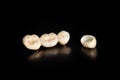 Ceramic crowns of human teeth closeup macro isolate on black background. The concept of aesthetic dentistry Royalty Free Stock Photo