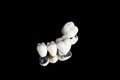 Ceramic dental crowns