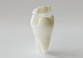 Ceramic Inlay crown over a tooth- 3D Rendering