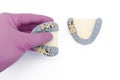 ceramic-metal crowns and bridges on the upper and lower jaws. dental prosthetics Royalty Free Stock Photo