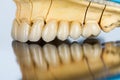 Ceramic teeth - dental bridge Royalty Free Stock Photo