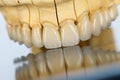 Ceramic teeth - dental bridge Royalty Free Stock Photo