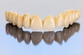 Ceramic teeth - dental bridge