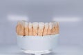 Ceramic tooth crown on plaster model. Finished new ceramic bridge on plaster model, frontal view. Dental veneers are Royalty Free Stock Photo