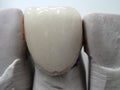 Ceramic veneer, artificial tooth pad