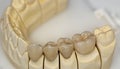 Ceramic zirconium. Teeth. Dental technician.