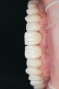 Ceramic zirconium in final version. Staining and glazing. Precision design and high quality materials. Dental health