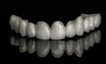 Ceramic zirconium. Teeth. Dental technician. Royalty Free Stock Photo