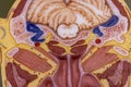 Cerebellum, Thalamus, Medulla oblongata, Spinal cord and Motor Neuron human under the microscope.