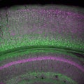 Cerebral cortex and part of the hippocampus