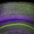 Cerebral cortex and part of the hippocampus