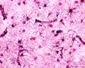 Cerebral cortex. Protoplasmic astrocytes Royalty Free Stock Photo