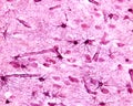 Cerebral cortex. Protoplasmic astrocytes Royalty Free Stock Photo