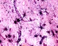 Cerebral cortex. Protoplasmic astrocytes