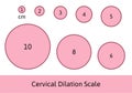 Cervial Dilation Scale with pink circles. Shows how cervix is opening during delivery procwss. Medical Illustration Royalty Free Stock Photo