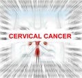 Cervical cancer