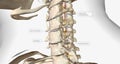 Cervical disc degeneration, or cervical disc disease, is a process that occurs naturally with age