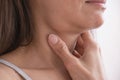 Cervical lymphadenitis of the right side in a woman. Royalty Free Stock Photo