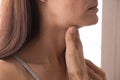 Cervical lymphadenitis of the right side in a woman. Royalty Free Stock Photo