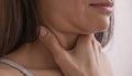 Cervical lymphadenitis of the right side in a woman. Royalty Free Stock Photo