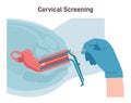 Cervical screening, gynecological examining concept. Cervix cancer