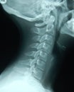 Cervical Spine Royalty Free Stock Photo