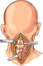 Cervical Spine illustration