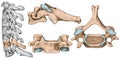 Cervical spine, sixth cervical vertebra