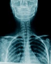 Cervical spine x-ray image Royalty Free Stock Photo