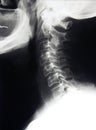 Cervical spine x-ray, neck Royalty Free Stock Photo