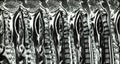 Cervical spondylosis with disc herniation ( MRI of cervical spine : show cervical spondylosis with disc herniation compress spinal Royalty Free Stock Photo