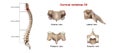 Cervical Vertebrae C6