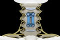 Cervical vertebrae fixed with a metal plate and screws. 3d render image