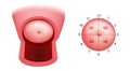 Cervix quadrants and directions. The anatomical position of the cervix. Cervix uteri anatomy. Colposcopy. Royalty Free Stock Photo