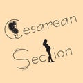 Cesarean section