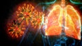 cg medical 3d illustration, human lungs troubles of covid