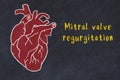 Concept of learning cardiovascular system. Chalk drawing of human heart and inscription Mitral valve regurgitation Royalty Free Stock Photo